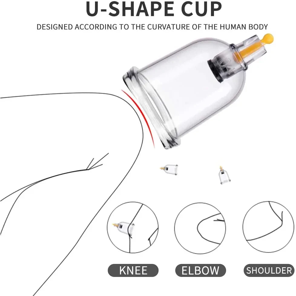 12-Piece Vacuum Cupping Therapy Set