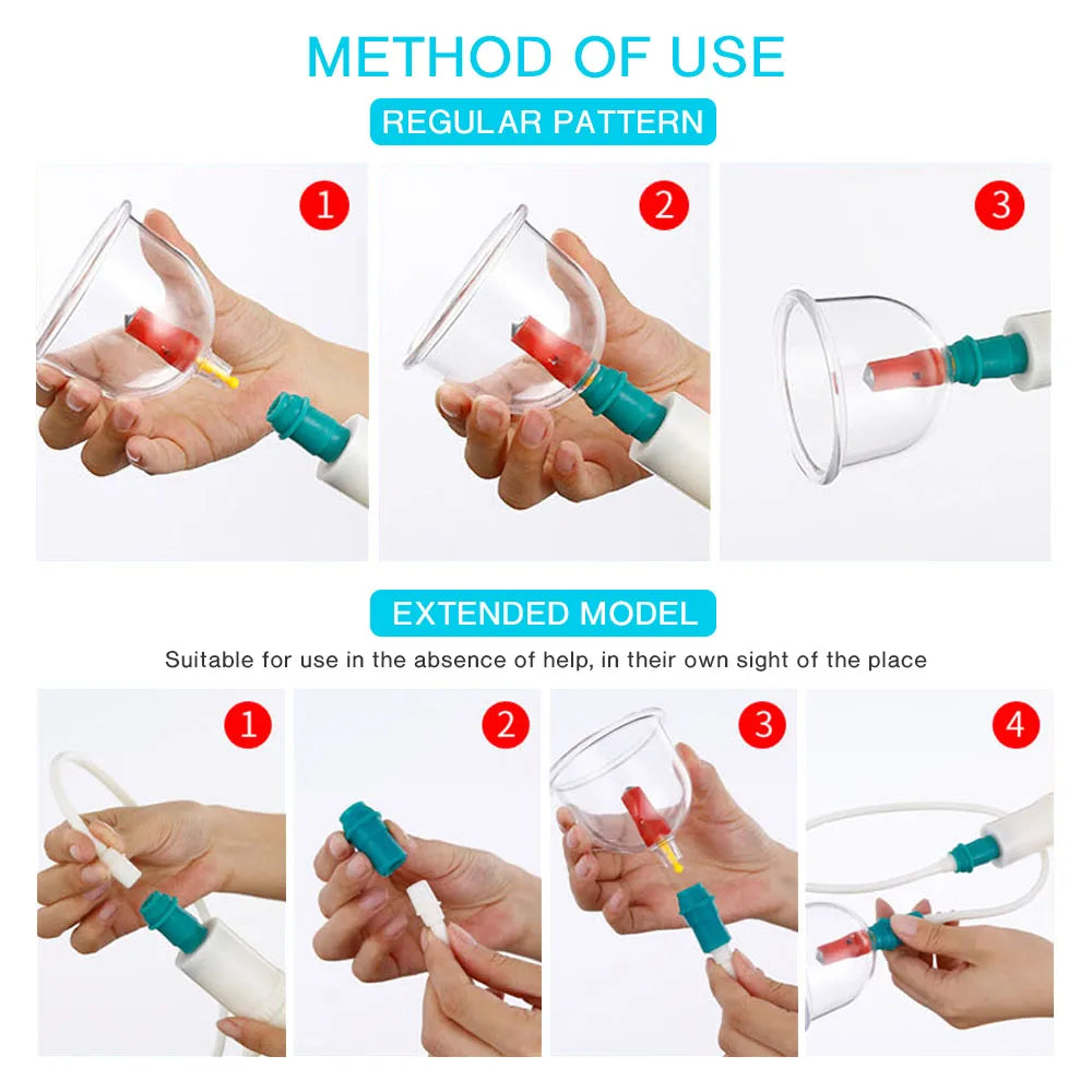 12-Piece Vacuum Cupping Therapy Set