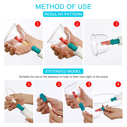 12-Piece Vacuum Cupping Therapy Set